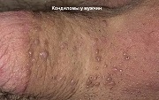 ВПЧ пути и способы заражения