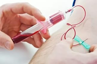 анализ крови из вены на вич