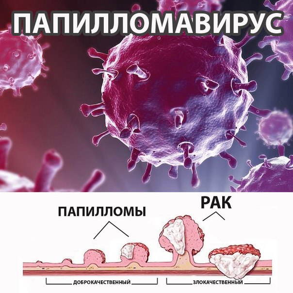 чем опасен впч