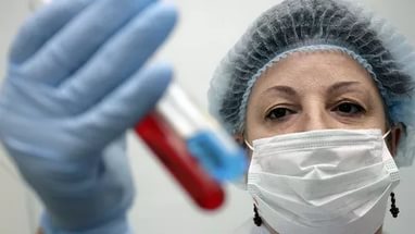 наблюдение за вич инфицированными