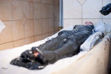 санаторий где лечат псориаз
