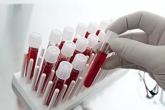 сколько делается кровь на вич