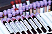сколько дней делается анализ на вич спид